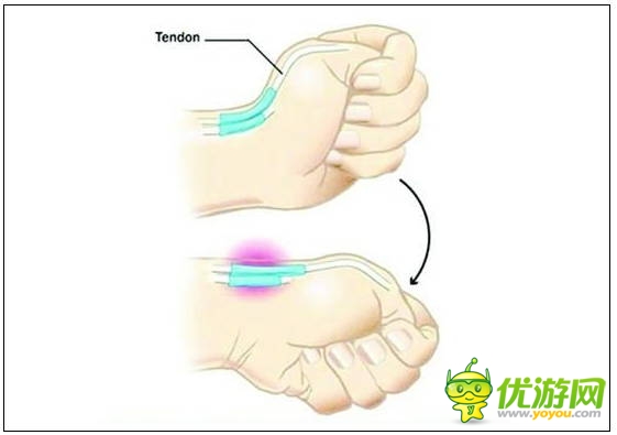 玩手機易患十大“智能手機病” 這些癥狀你都有嗎？
